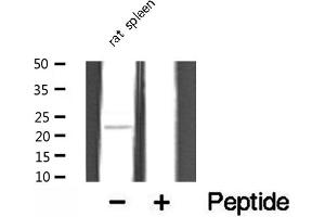 Western blot analysis of extracts from rat spleen, using TUSC5 antibody. (TUSC5 antibody  (N-Term))