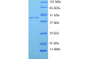 SDS-PAGE (SDS) image for H2A Histone Family, Member J (H2AFJ) (AA 2-129) protein (GST tag) (ABIN4975954)