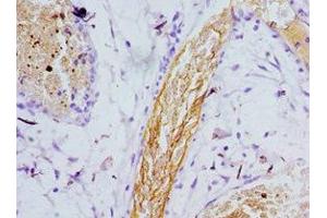 Immunohistochemistry of paraffin-embedded human epityphlon tissue using ABIN7164263 at dilution of 1:100 (Presenilin 1 antibody  (AA 1-160))