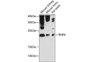 Western blot analysis of extracts of various cell lines, using RNF4 antibody (ABIN6129121, ABIN6147041, ABIN6147042 and ABIN6215602) at 1:3000 dilution. (RNF4 antibody  (AA 1-190))