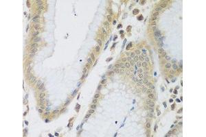 Immunohistochemistry of paraffin-embedded Human stomach using ENPEP Polyclonal Antibody at dilution of 1:200 (40x lens). (ENPEP antibody)