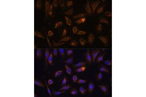Immunofluorescence analysis of U-2 OS cells using RGS4 antibody (ABIN7269898) at dilution of 1:100. (RGS4 antibody  (AA 1-100))
