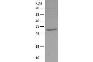 Western Blotting (WB) image for PIH1 Domain Containing 2 (PIH1D2) (AA 1-315) protein (His tag) (ABIN7124451) (PIH1D2 Protein (AA 1-315) (His tag))