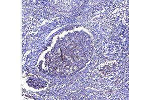 IHC analysis of TAPA1 using anti-TAPA1 antibody . (CD81 antibody  (AA 113-201))