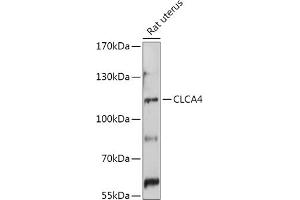 Western blot analysis of extracts of Rat uterus, using CLC antibody (ABIN7266332) at 1:1000 dilution.