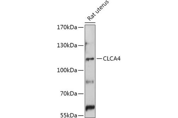 CLCA4 antibody  (AA 22-150)