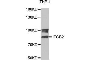 Western blot analysis of extracts of THP-1 cell lines, using ITGB2 antibody. (Integrin beta 2 antibody  (AA 70-170))