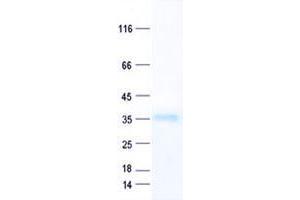 Validation with Western Blot (TADA2L Protein (His tag))