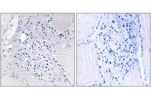Immunohistochemistry analysis of paraffin-embedded human thyroid gland tissue, using C9orf89 Antibody. (C9orf89 antibody  (AA 21-70))