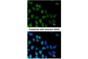 ICC/IF Image Immunofluorescence analysis of paraformaldehyde-fixed Human ESC, using ZNF281, antibody at 1:100 dilution. (ZNF281 antibody)