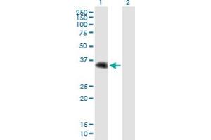 Western Blot analysis of CENPV expression in transfected 293T cell line by CENPV MaxPab polyclonal antibody. (CENPV antibody  (AA 1-275))