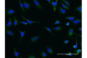 Immunofluorescence of monoclonal antibody to SIK2 on HeLa cell. (SIK2 antibody  (AA 467-576))