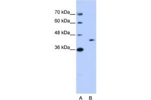 Western Blotting (WB) image for anti-GIPC PDZ Domain Containing Family, Member 1 (GIPC1) antibody (ABIN2462192) (GIPC1 antibody)