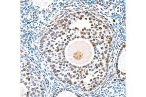 Immunohistochemistry (Paraffin-embedded Sections) (IHC (p)) image for anti-Topoisomerase (DNA) II alpha 170kDa (TOP2A) antibody (ABIN7075937)