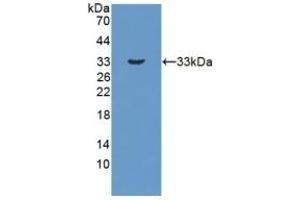 Detection of Recombinant HSD17b3, Human using Polyclonal Antibody to 17-Beta-Hydroxysteroid Dehydrogenase Type 3 (HSD17b3) (HSD17B3 antibody  (AA 1-310))