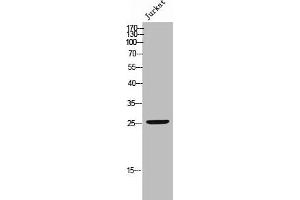Western Blot analysis of JK cells using Phospho-Bcl-2 (S70) Polyclonal Antibody (Bcl-2 antibody  (pSer70))