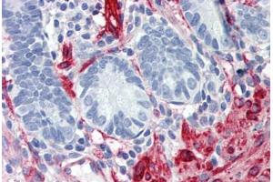 Human Small Intestine: Formalin-Fixed, Paraffin-Embedded (FFPE) (Filamin A antibody  (AA 1-839))