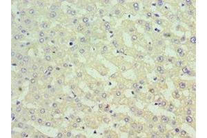 Immunohistochemistry of paraffin-embedded human liver tissue using ABIN7171013 at dilution of 1:100 (SUFUH antibody  (AA 325-484))