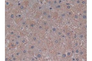 Immunohistochemistry (IHC) image for anti-Complement Component 5a (C5a) (AA 678-751) antibody (ABIN7442321)