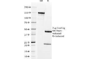 SDS-PAGE Analysis Purified Prolactin Receptor Mouse Monoclonal Antibody (B6.