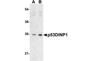 Western Blotting (WB) image for anti-Tumor Protein P53 Inducible Nuclear Protein 1 (TP53INP1) (N-Term) antibody (ABIN1031500)