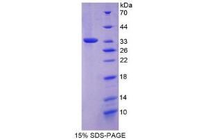 SDS-PAGE (SDS) image for FOS-Like Antigen 1 (FOSL1) (AA 1-273) protein (His tag) (ABIN2124872) (FOSL1 Protein (AA 1-273) (His tag))