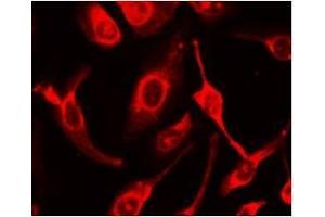 Immunocytochemical staining of HeLa Cells (FAS antibody  (N-Term))