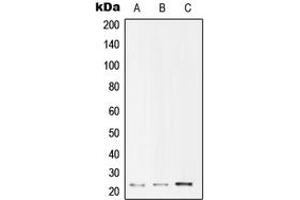 Western blot analysis of UBE2T expression in Jurkat (A), HepG2 (B), HeLa (C) whole cell lysates. (Ube2t antibody  (Center))
