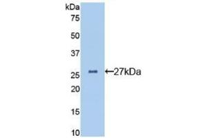 Detection of Recombinant CLU, Mouse using Polyclonal Antibody to Clusterin (CLU) (Clusterin antibody  (AA 227-448))