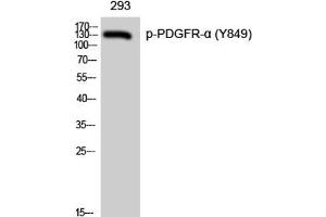 Western Blot analysis of 293 cells with Phospho-PDGFRA (Tyr849) Polyclonal Antibody (PDGFRA antibody  (pTyr849))