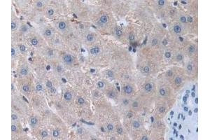 DAB staining on IHC-P; Samples: Human Liver Tissue (MMP15 antibody  (AA 280-497))