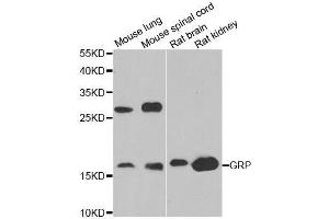 Western blot analysis of extracts of various cell lines, using GRP antibody. (Gastrin-Releasing Peptide antibody  (AA 1-148))