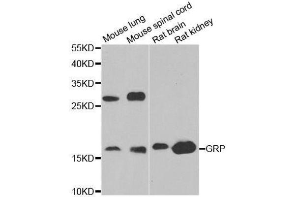 Gastrin-Releasing Peptide antibody  (AA 1-148)