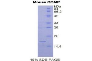 SDS-PAGE (SDS) image for Cartilage Oligomeric Matrix Protein (COMP) (AA 40-180) protein (His tag) (ABIN2120734)