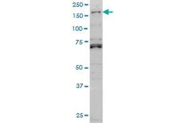 LMTK3 Antikörper  (AA 1151-1250)