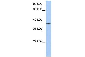 TMCC1 antibody used at 1 ug/ml to detect target protein. (TMCC1 antibody  (C-Term))