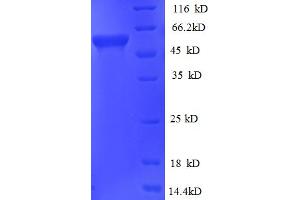 SDS-PAGE (SDS) image for Glycerol Kinase (GK) (AA 1-496), (full length) protein (His tag) (ABIN5711201) (Glycerol Kinase Protein (GK) (AA 1-496, full length) (His tag))