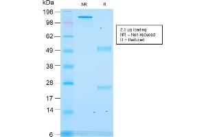 SDS-PAGE Analysis Purified ACTH Recombinant Mouse Monoclonal Antibody (rCLIP/1418).