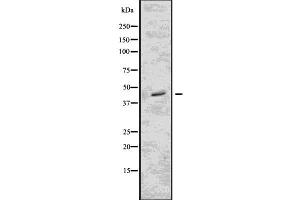 Western blot analysis of FCGR2B using Jurkat whole  lysates. (FCGR2B antibody  (C-Term))