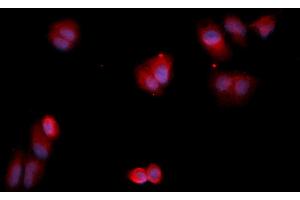 Immunofluorescence (IF) image for anti-Annexin A13 (ANXA13) (AA 1-316) antibody (APC) (ABIN5564969) (Annexin A13 antibody  (AA 1-316) (APC))