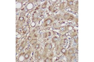 Immunohistochemistry of paraffin-embedded human liver using NDUFB8 Rabbit pAb (ABIN7268814) at dilution of 1:100 (40x lens). (NDUFB8 antibody)