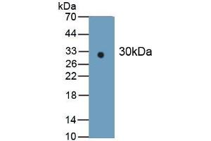 Detection of Recombinant IDH1, Human using Monoclonal Antibody to Isocitrate Dehydrogenase 1, Soluble (IDH1) (IDH1 antibody  (AA 74-333))