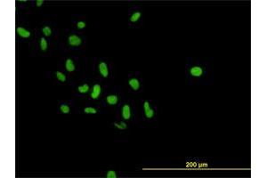 Immunofluorescence (IF) image for anti-Poly (ADP-Ribose) Polymerase 1 (PARP1) (AA 1-100) antibody (ABIN559798)