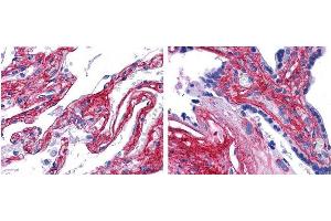 抗V型胶原抗体（600-401-107 Lot 22063，1:200，45 min RT）在人肺FFPE切片（左）中呈强染色，在肺泡、血管和结缔组织间隙中呈强染；胎盘（右），基质、结缔组织间隙和血管壁可见强染色。（V型胶原抗体（生物素））