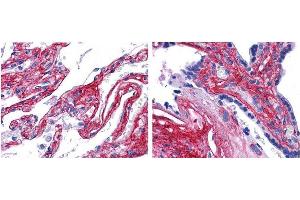 anti collagen V antibody (600-401-107 Lot 22063, 1:200, 45 min RT) showed strong staining in FFPE sections of human lung (left) with strong staining within alveoli, vessels, and in connective tissue spaces; and placenta (right) with strong staining observed in stromal and connective tissue spaces and vessel walls. (Collagen Type V antibody  (Biotin))