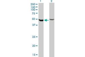 Western Blotting (WB) image for anti-DEAD (Asp-Glu-Ala-Asp) Box Polypeptide 6 (DDX6) (AA 1-484) antibody (ABIN598641) (DDX6 antibody  (AA 1-484))