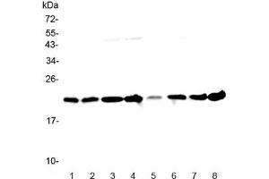 Western blot testing of human 1) HeLa, 2) placenta, 3) MCF7, 4) COLO320, 5) 22RV1, 6) HepG2, 7) A431 and 8) U937 lysate with GLO1 antibody at 0. (GLO1 antibody)
