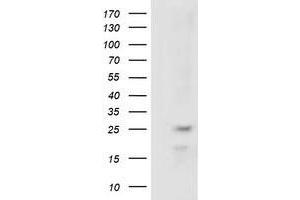 HEK293T cells were transfected with the pCMV6-ENTRY control (Left lane) or pCMV6-ENTRY RABL2A (Right lane) cDNA for 48 hrs and lysed. (RABL2A antibody)