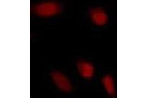 Immunofluorescence (IF) image for anti-Glutamate-Rich WD Repeat Containing 1 (GRWD1) (full length) antibody (ABIN2451991)