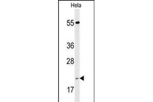 Western blot analysis of IC Antibody (Center) (ABIN653304 and ABIN2842804) in Hela cell line lysates (35 μg/lane). (PPIC antibody  (AA 61-89))